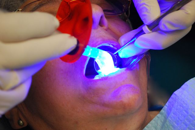 Close-up of a curing light procedure using blue UV light inside a patient's mouth.
